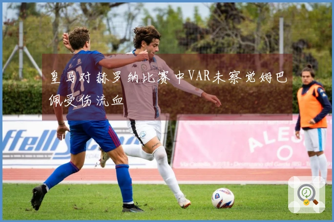 皇马对赫罗纳比赛中VAR未察觉姆巴佩受伤流血